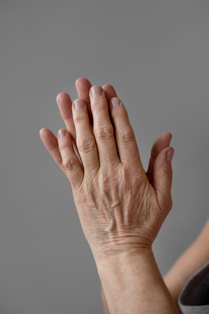 Veias dilatadas na mãos