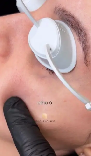 Olheira Vascular - Dr Rodolpho Reis Angiologista